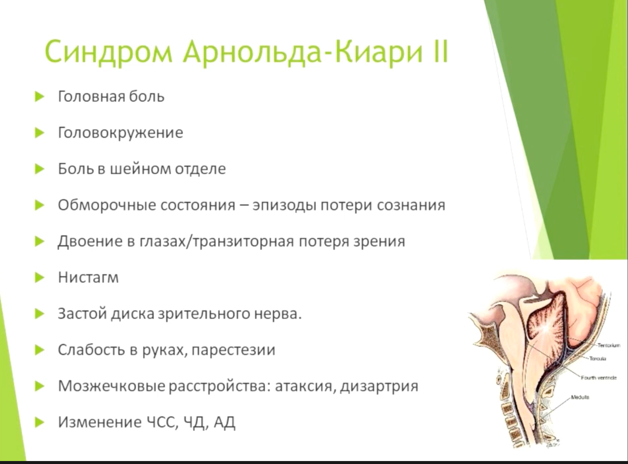 Спинномозговые грыжи